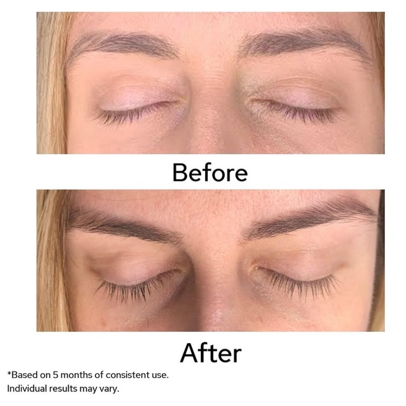 Dr. Lara Devgan Platinum Long Lash Serum NWT - Picture 2 of 6